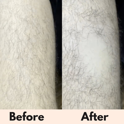 Soluna Electric Shaver™